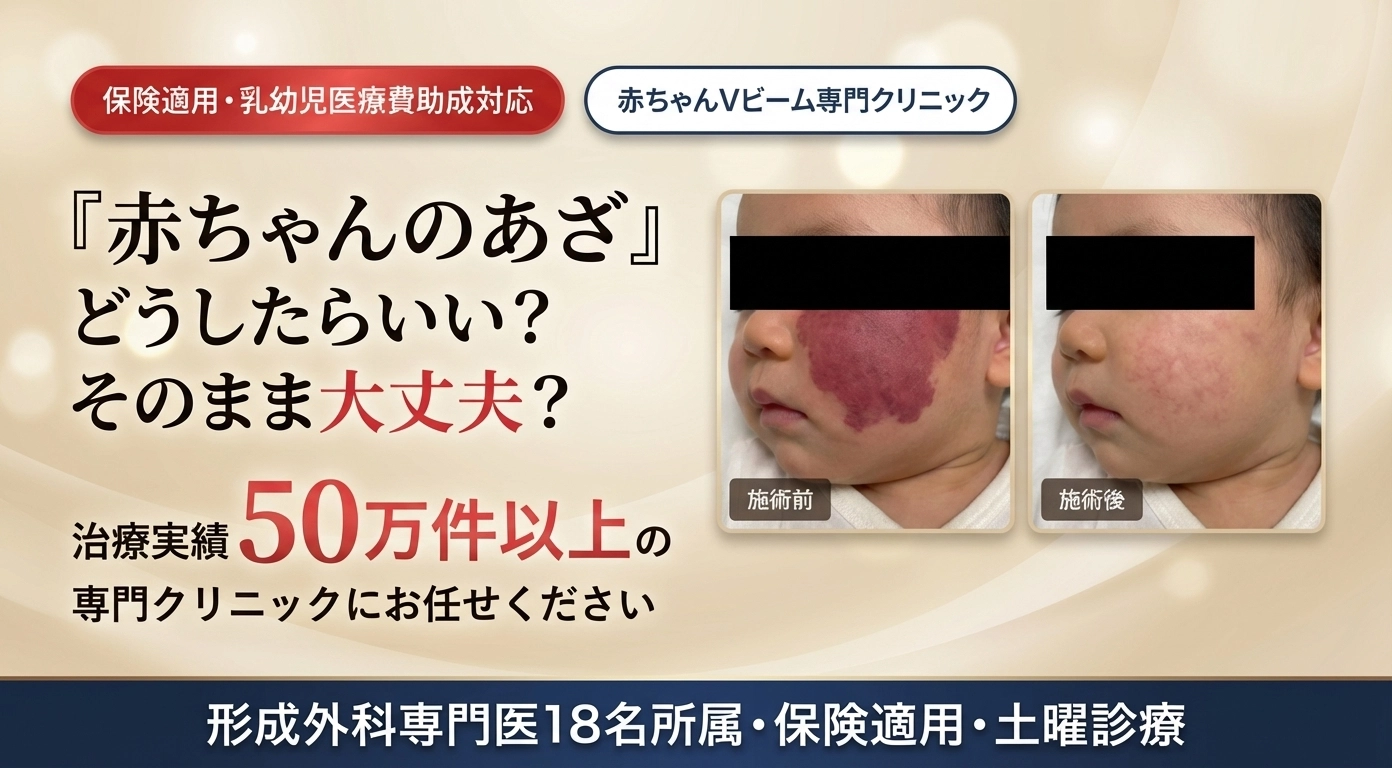赤ちゃんのあざ どうしたらいい？そのまま大丈夫？ 治療実績50万件以上の専門クリニックにお任せください 保険適用・乳幼児医療費助成対応 形成外科専門医18名所属・保険適用・土曜診療