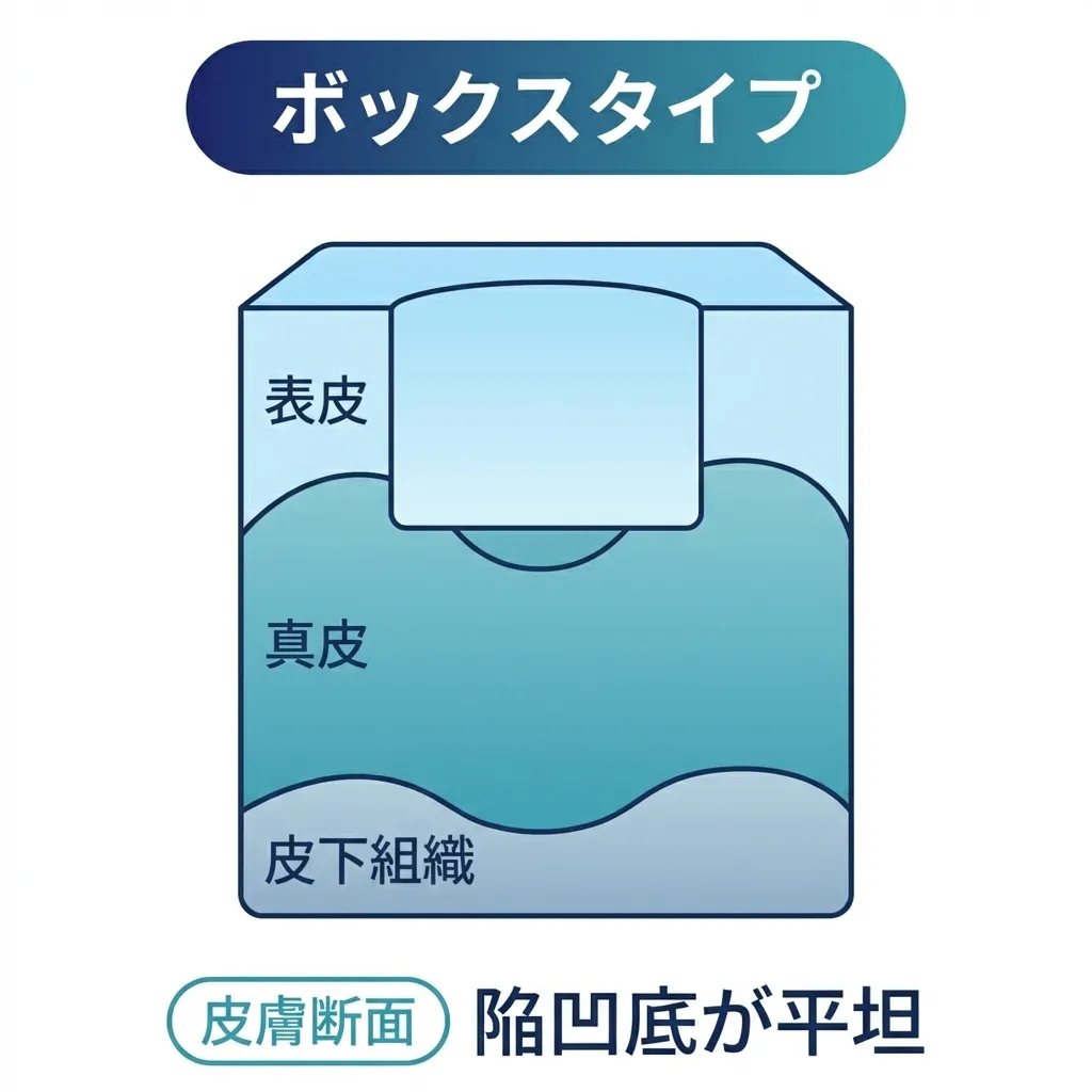 ボックス型クレーター