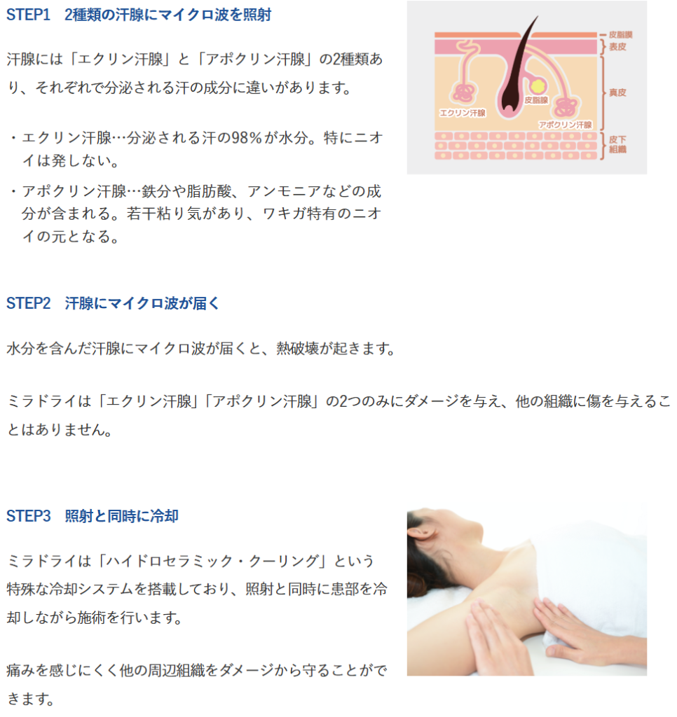 miraDry treatment