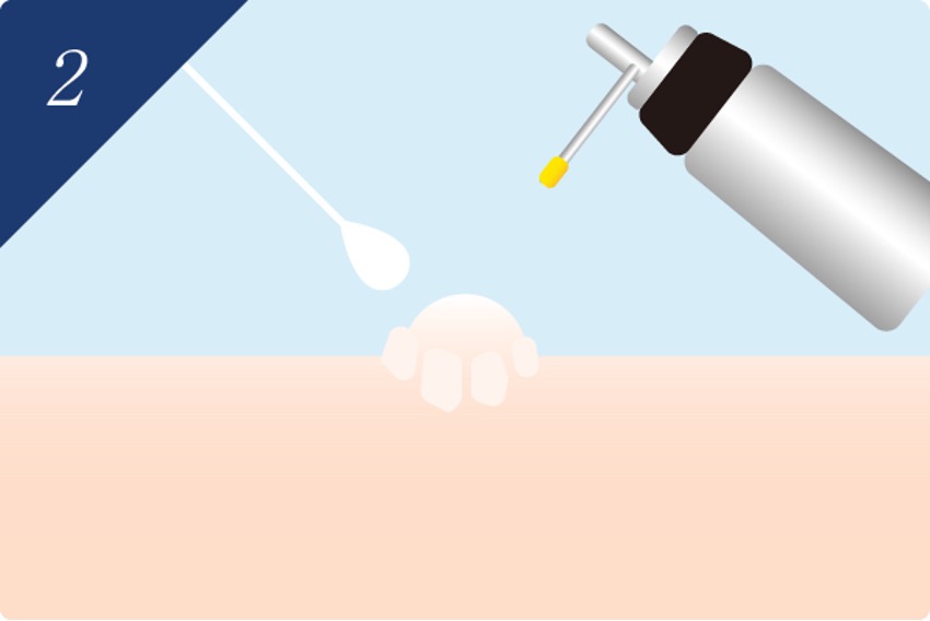 STEP2の画像