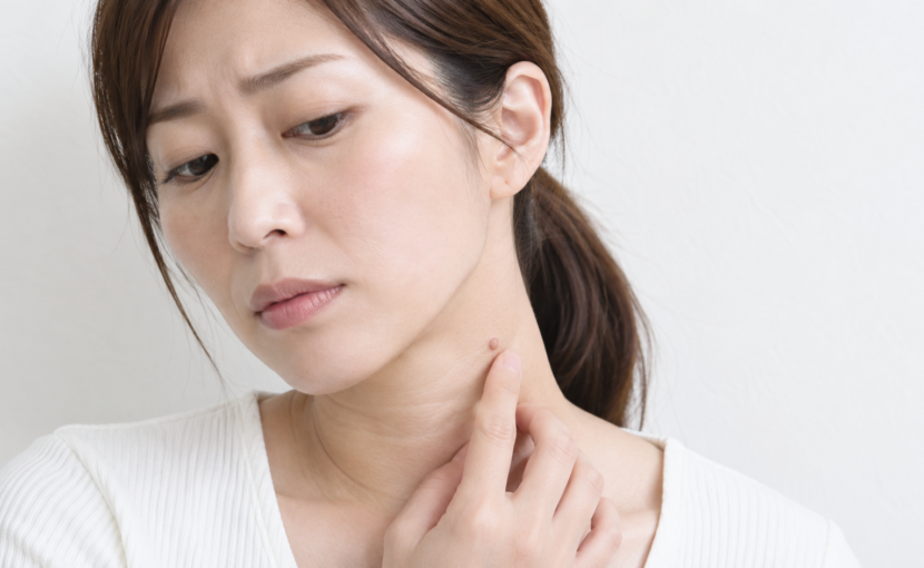 首のイボを気にして触れている女性